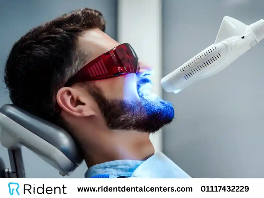 كل ما تحتاج معرفته عن تبييض الاسنان بالليزر 2025